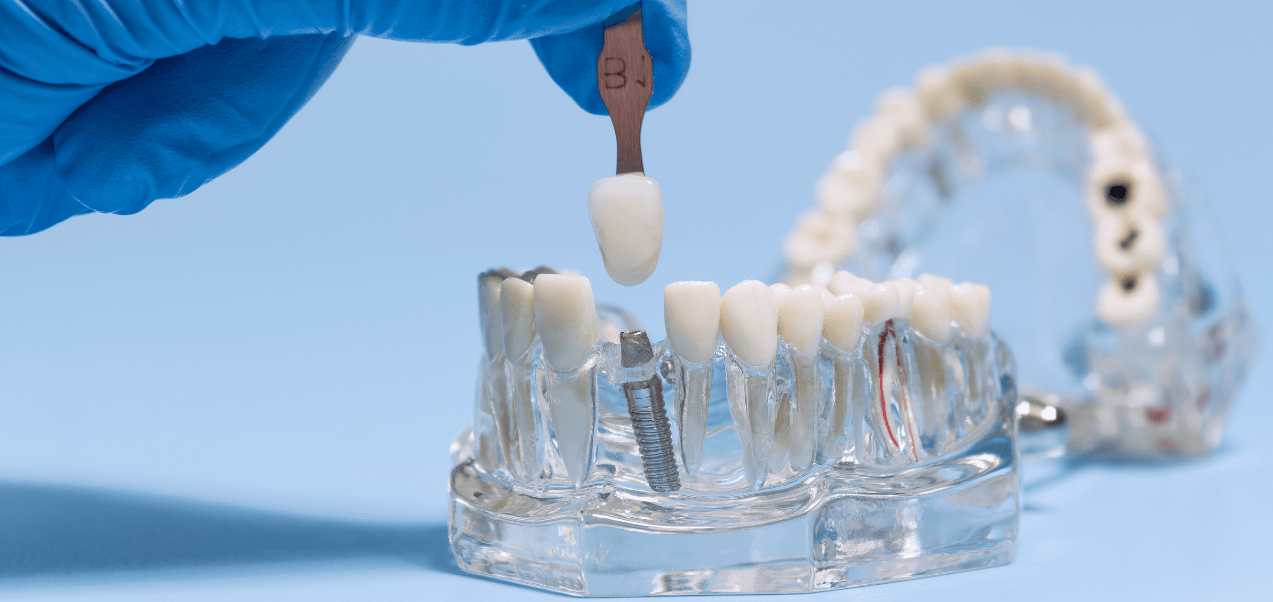 What dental implant courses are available in 2026 exploring global trends